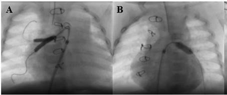 Descripción: img356
