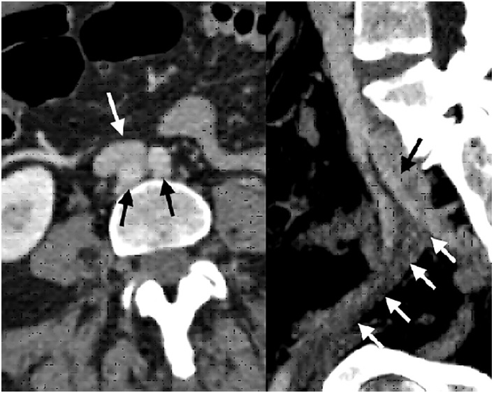 Imagen de estudio dividida en 2