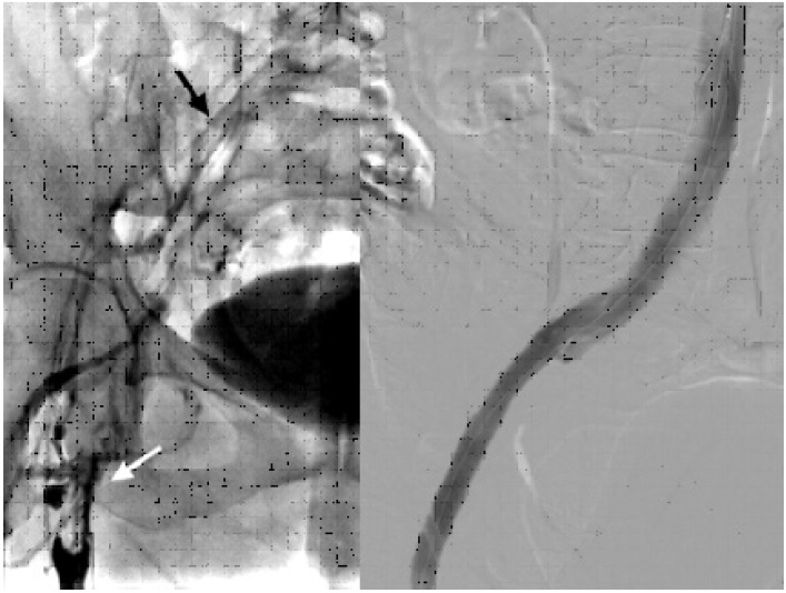 Imagen de estudio dividida en 2