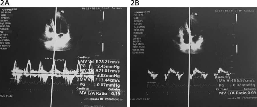 Fig. 2. A.