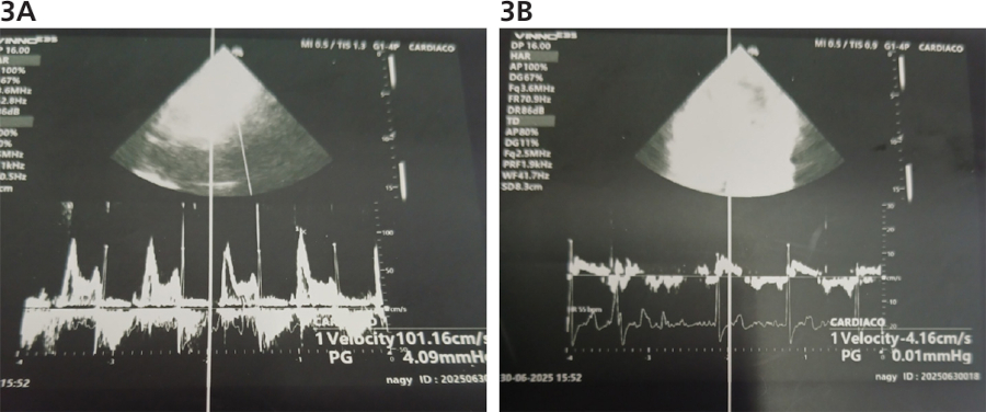 Fig. 3. A.