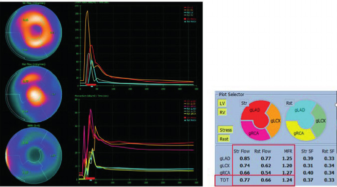 rac - Analysis of Myocardial Flow Reserve in Patients with ...