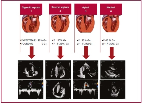 Descripción: C:\Users\Guido\Downloads\figura 4 streitenberger ingles.jpg