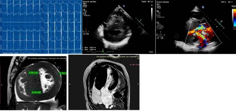 Descripción: C:\Users\Guido\Downloads\figura 5 anexo streitenberger ingles.jpg